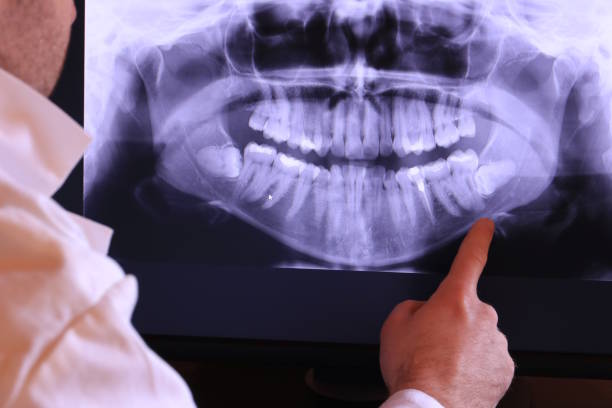 Best Dentist for Severe Toothache  in Williston, FL