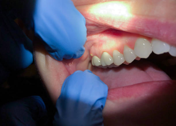 Best Cracked Tooth Emergency Dentist  in Williston, FL