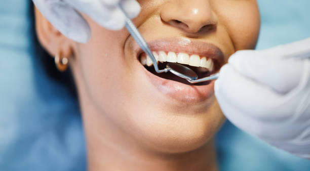 Best Chipped Tooth Repair Near Me  in Williston, FL